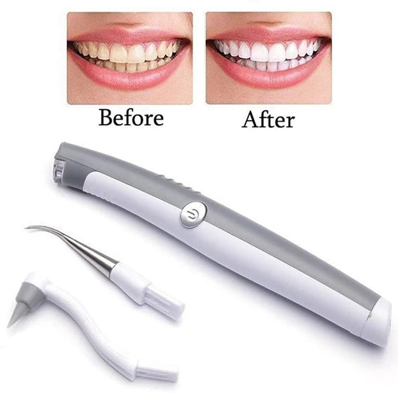 Electric Sonic Dental Teeth Plaque Remover Whitening Kit