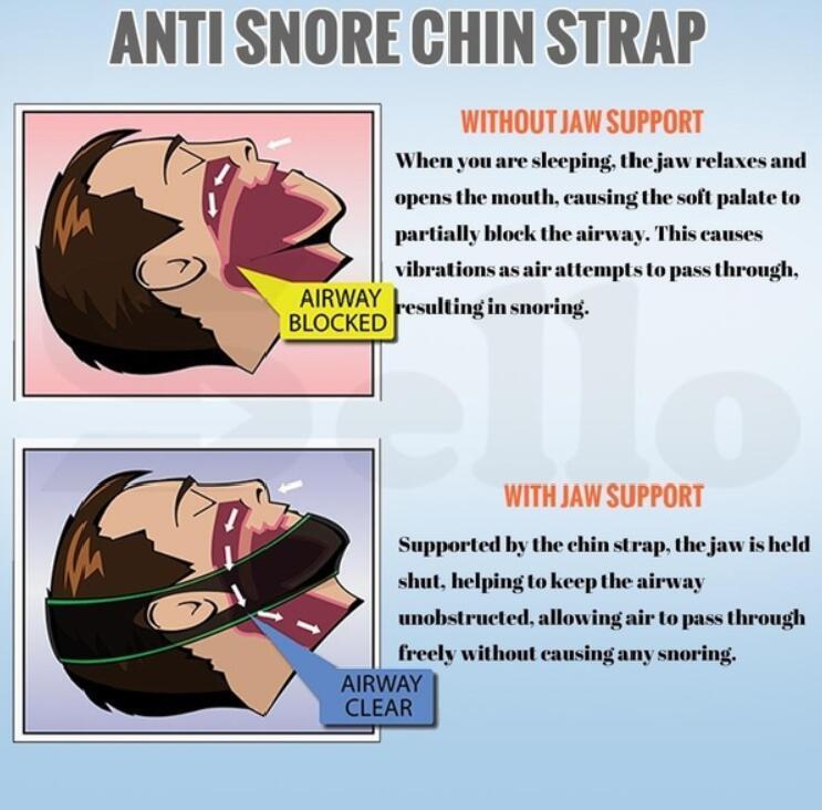 Anti Snore Stop Snoring Chin Strap Belt