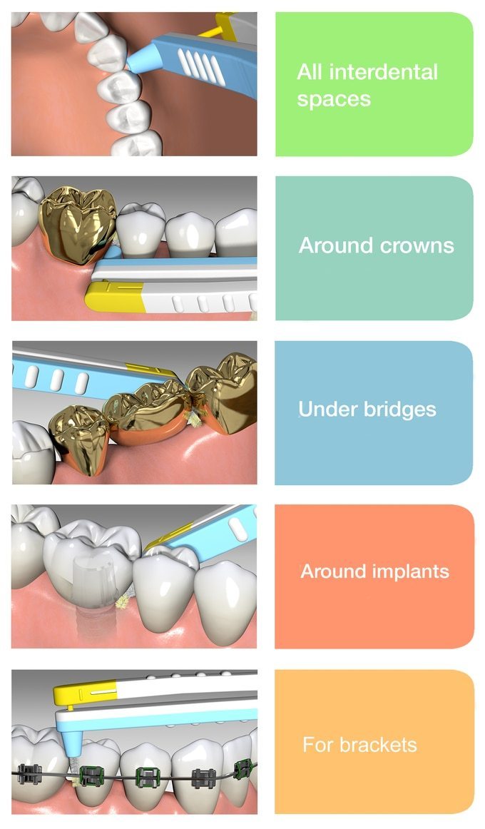 Wingbrush Interdental Brushes