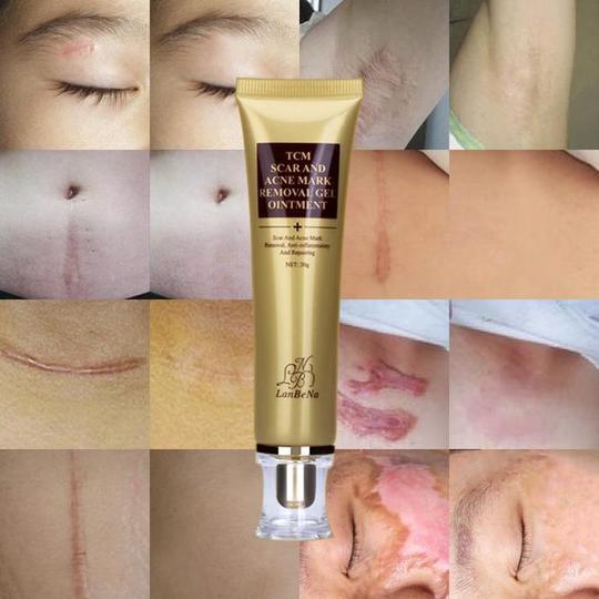 Acne Scar Removal Cream Skin Care Ginseng Extract