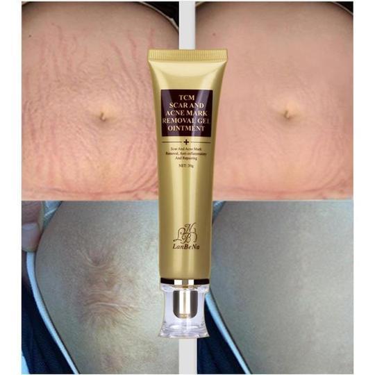 Acne Scar Removal Cream Skin Care Ginseng Extract