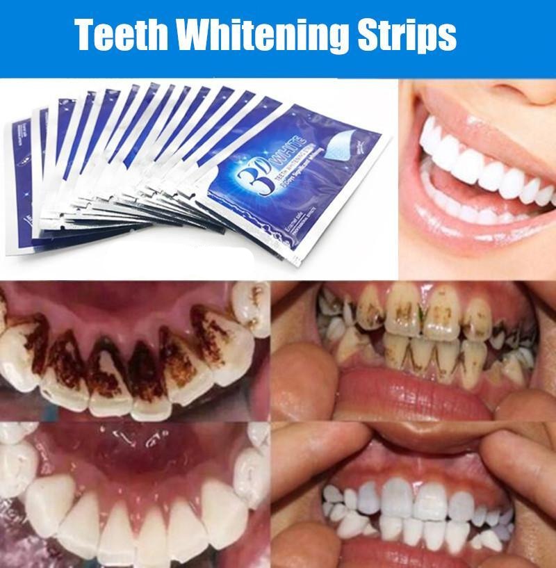 Teeth Whitening Strips