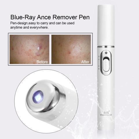 Best Blue Light Laser Pen for Spots, Scars & Blemishes