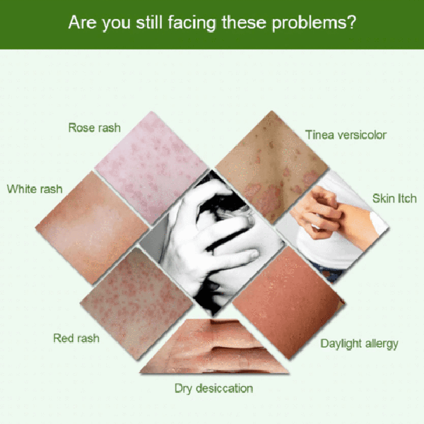 Skin Solutions Cream