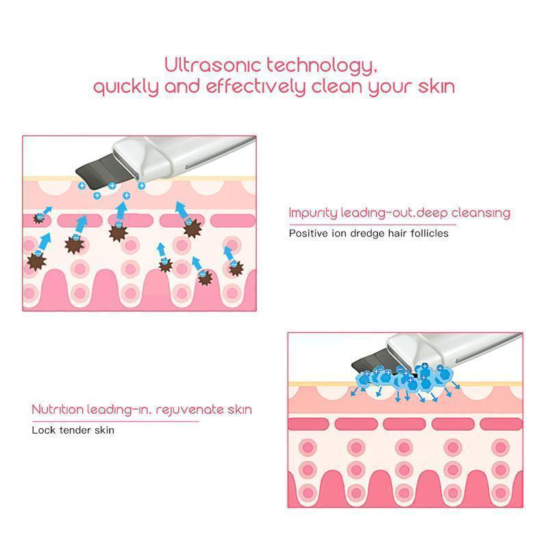 Deep Cleansing Ultrasonic Skin Revitalizer